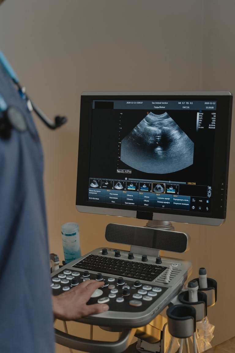 Ultrasonogrāfija (USG) - efektīva diagnostikas metode, kas sniedz informāciju par dažādu orgānu un audu stāvokli.